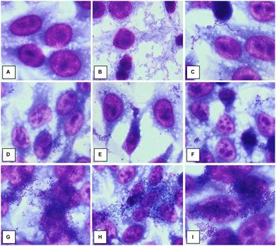 Clinical and microbiological features of host-bacterial interplay in chronic venous ulcers versus other types of chronic skin ulcers